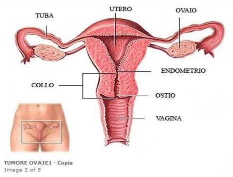 Endometrio engrosamiento