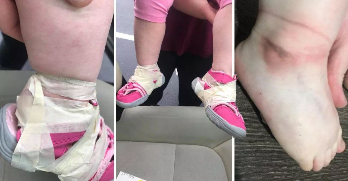 Shock all'asilo: nastro isolante per non fare togliere le scarpe ai bimbi -  SiciliafanSiciliafan