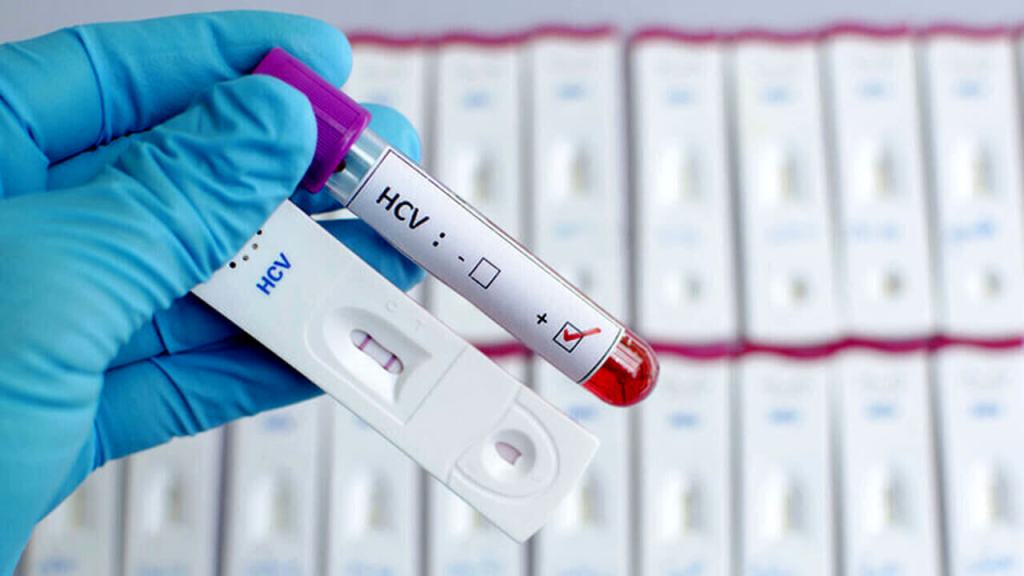 Screening HCV
